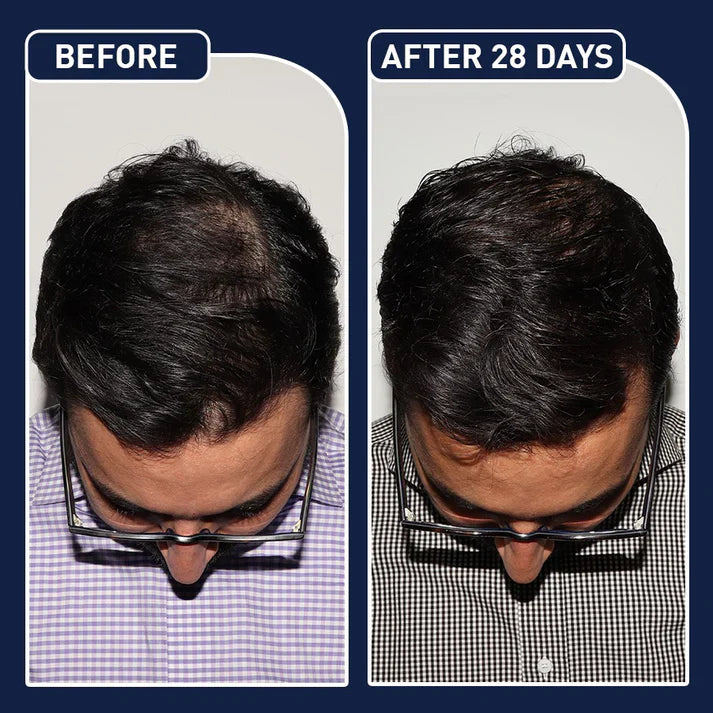 FEG Hair Growth Spray – Natural Hair Thickening & Scalp Repair Treatment | Emiravaly UAE