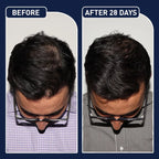 FEG Hair Growth Spray – Natural Hair Thickening & Scalp Repair Treatment | Emiravaly UAE