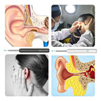 Earwax Removal Kit with LED Light & Soft Tips