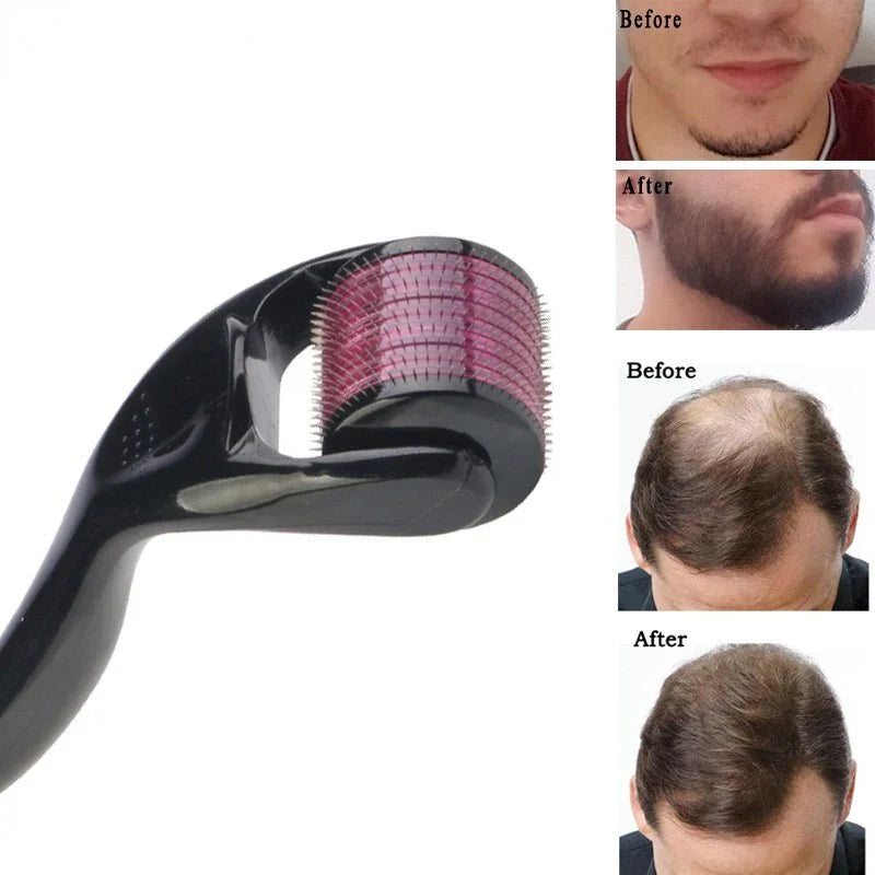 Derma Roller System – Microneedle Tool for Face, Beard & Scalp Skin Glow | Emiravaly UAE