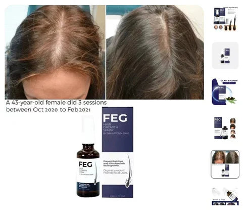 FEG Hair Growth Spray – Natural Hair Thickening & Scalp Repair Treatment | Emiravaly UAE