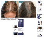 FEG Hair Growth Spray – Natural Hair Thickening & Scalp Repair Treatment | Emiravaly UAE