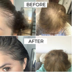 FEG Hair Growth Spray – Natural Hair Thickening & Scalp Repair Treatment | Emiravaly UAE