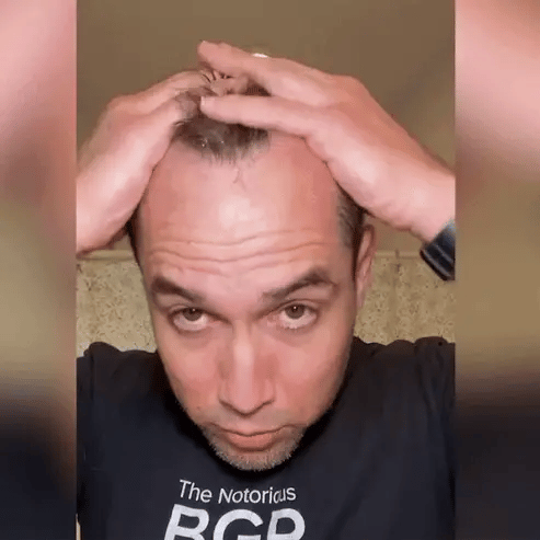 FEG Hair Growth Spray – Natural Hair Thickening & Scalp Repair Treatment | Emiravaly UAE